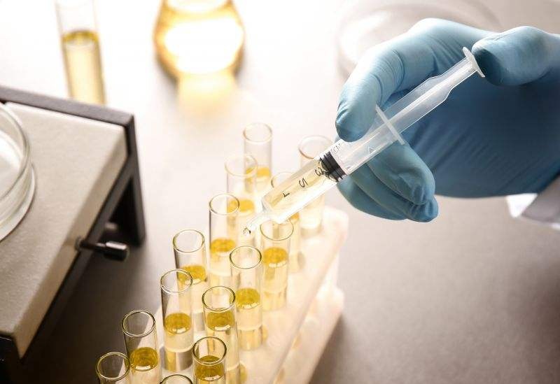 尿檢能檢測(cè)出來什么問題？