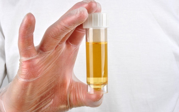 尿檢能檢測(cè)出來什么問題？